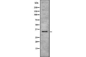 Western blot analysis of HSD17B1 using MCF7 whole  lysates. (HSD17B1 antibody  (C-Term))