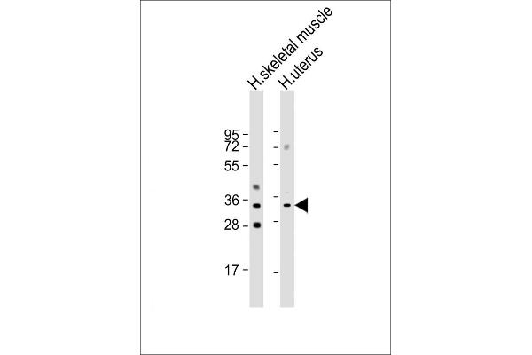 R-Spondin 3 antibody  (AA 197-230)