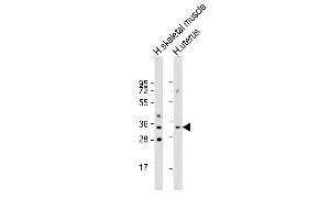 All lanes : Anti-RSPO3 Antibody (C-Term) at 1:8000 dilution Lane 1: human skeletal muscle lysate Lane 2: human uterus lysate Lysates/proteins at 20 μg per lane. (R-Spondin 3 antibody  (AA 197-230))