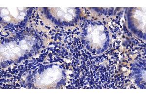 Detection of CNN1 in Human Appendix Tissue using Polyclonal Antibody to Calponin 1, Basic (CNN1) (CNN1 antibody  (AA 1-268))