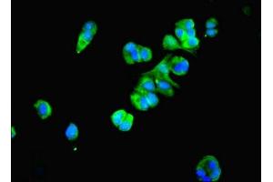 Immunofluorescent analysis of MCF-7 cells using ABIN7164978 at dilution of 1:100 and Alexa Fluor 488-congugated AffiniPure Goat Anti-Rabbit IgG(H+L) (PSMB4 antibody  (AA 46-264))
