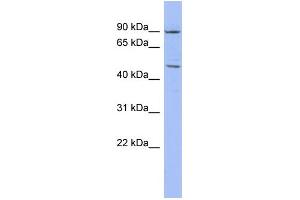 WB Suggested Anti-ZNF569 Antibody Titration:  0.
