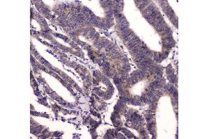 IHC analysis of BRD7 using anti-BRD7 antibody . (BRD7 antibody  (AA 514-567))