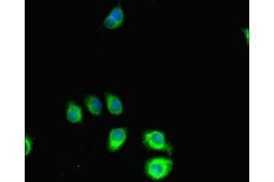 Immunofluorescent analysis of A549 cells using ABIN7169823 at dilution of 1:100 and Alexa Fluor 488-congugated AffiniPure Goat Anti-Rabbit IgG(H+L) (SLIT-ROBO rho GTPase Activating Protein 2C (SRGAP2C) (AA 1-242) antibody)