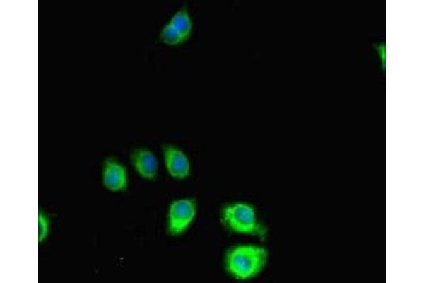 SLIT-ROBO rho GTPase Activating Protein 2C (SRGAP2C) (AA 1-242) Antikörper