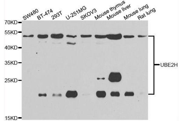 UBE2H 抗体  (AA 1-183)