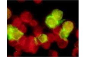 Immunofluorescence (IF) image for anti-Epstein-Barr Virus Membrane Antigen gp350 (EBV gp350) antibody (ABIN265550) (EBV-Gp350 antibody)