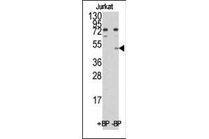 Western blot analysis of anti-MINA (C-term) Pab pre-incubated with and without blocking peptide (BP)(catlog :BP1033b) in Jurkat cell line lysate. (MINA antibody  (C-Term))