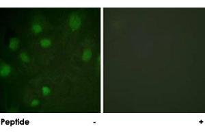 Immunofluorescence analysis of HeLa cells, using IGF2R polyclonal antibody . (IGF2R antibody)