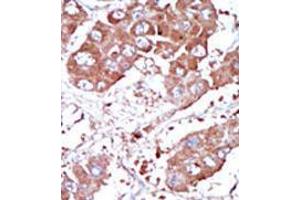 Image no. 2 for anti-Bone Morphogenetic Protein Receptor 1A (BMPR1A) (Middle Region) antibody (ABIN357375)
