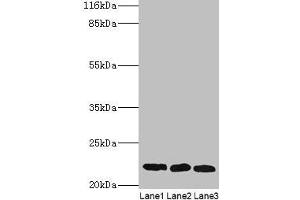 Western blot All lanes: SSSCA1 antibody at 2 μg/mL Lane 1: A549 whole cell lysate Lane 2: MCF-7 whole cell lysate Lane 3: 293T whole cell lysate Secondary Goat polyclonal to rabbit IgG at 1/10000 dilution Predicted band size: 22 kDa Observed band size: 22 kDa (SSSCA1 antibody  (AA 2-199))