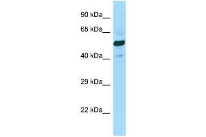WB Suggested Anti-SUCLG2 Antibody Titration: 1. (SUCLG2 antibody  (C-Term))
