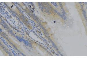 ABIN6279109 at 1/100 staining Mouse colon tissue by IHC-P. (CTNNAL1 antibody  (Internal Region))