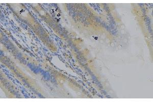 ABIN6279109 at 1/100 staining Mouse colon tissue by IHC-P. (CTNNAL1 antibody  (Internal Region))