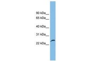 Image no. 1 for anti-Glutathione S-Transferase kappa 1 (GSTK1) (AA 107-156) antibody (ABIN6745090) (GSTK1 antibody  (AA 107-156))
