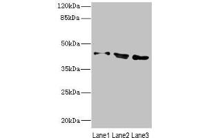 Western blot All lanes: CAMK1Dantibody at 2. (CAMK1D antibody  (AA 1-180))