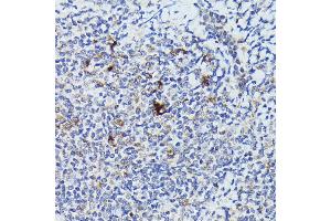 Immunohistochemistry of paraffin-embedded human tonsil using Cathepsin G Rabbit pAb (ABIN6127687, ABIN6139229, ABIN6139231 and ABIN6221273) at dilution of 1:50 (40x lens).
