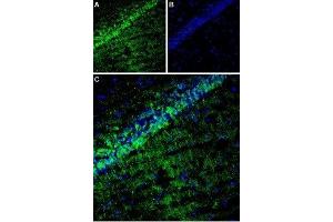 Immunohistochemistry (IHC) image for anti-Calcium Channel, Voltage-Dependent, gamma Subunit 8 (CACNG8) (AA 2-17), (Intracellular) antibody (ABIN7042996)