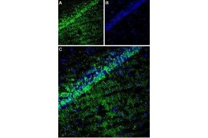 Expression of TARP γ8 (CACNG8) in rat hippocampus - Immunohistochemical staining of rat hippocampus using Anti-CACNG8 Antibody (ABIN7042996, ABIN7044073 and ABIN7044074). (CACNG8 antibody  (Intracellular, N-Term))