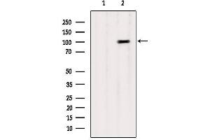 Western blot analysis of extracts from B16F10, using CTNNA1 Antibody. (CTNNA1 antibody  (Internal Region))