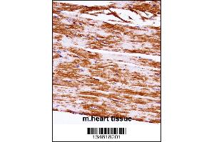 Mouse Map3k5 Antibody immunohistochemistry analysis in formalin fixed and paraffin embedded mouse heart tissue followed by peroxidase conjugation of the secondary antibody and DAB staining. (ASK1 antibody  (C-Term))