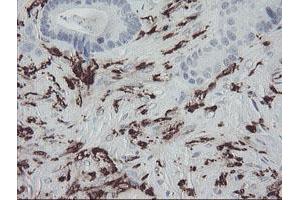 Image no. 2 for anti-Coagulation Factor XIII, A1 Polypeptide (F13A1) antibody (ABIN1498150) (F13A1 antibody)