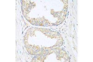 Immunohistochemistry of paraffin-embedded human prostate using SGCB antibody at dilution of 1:100 (40x lens).