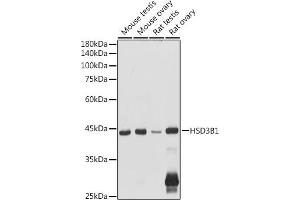 Western blot analysis of extracts of various cell lines, using HSD3B1 antibody (ABIN6131041, ABIN6142016, ABIN6142017 and ABIN6224059) at 1:1000 dilution.