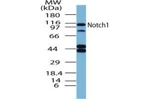 Image no. 1 for anti-Notch 1 (NOTCH1) (AA 1755-1767) antibody (ABIN207749) (Notch1 antibody  (AA 1755-1767))