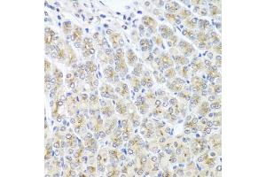 Immunohistochemistry of paraffin-embedded mouse stomach using MTX1 antibody (ABIN5975223) at dilution of 1/100 (40x lens). (Metaxin 1 antibody)