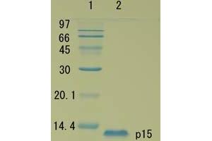 SDS-PAGE (SDS) image for HIV-1 Gag P15 protein (ABIN2452192) (HIV-1 Gag P15 Protein)