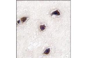 Formalin-fixed and paraffin-embedded human brain tissue reacted with CABP1 antibody (C-term), which was peroxidase-conjugated to the secondary antibody, followed by DAB staining. (CABP1 antibody  (C-Term))