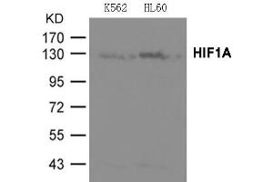 Western Blotting (WB) image for anti-Hypoxia Inducible Factor 1, alpha Subunit (Basic Helix-Loop-Helix Transcription Factor) (HIF1A) (AA 817-821) antibody (ABIN7138362)
