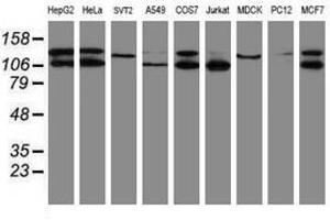Image no. 2 for anti-SUMO1/sentrin/SMT3 Specific Peptidase 2 (SENP2) (AA 139-523) antibody (ABIN1490928) (SENP2 antibody  (AA 139-523))