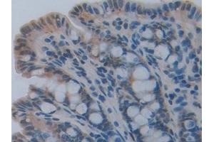 Detection of CASP12 in Mouse Small intestine Tissue using Polyclonal Antibody to Caspase 12 (CASP12)