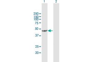 Western Blot analysis of ACAD8 expression in transfected 293T cell line by ACAD8 MaxPab polyclonal antibody. (Acad8 antibody  (AA 1-415))