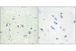 Immunohistochemistry analysis of paraffin-embedded human brain tissue, using GAS6 Antibody. (GAS6 antibody  (AA 291-340))