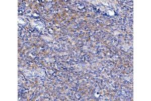 IHC analysis of TRIM6 using anti-TRIM6 antibody (ABIN7601905).