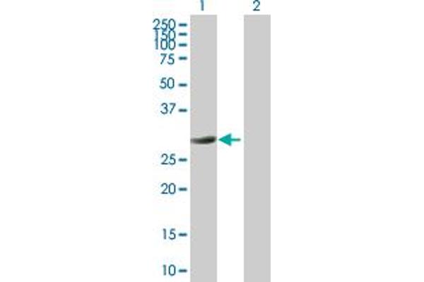 PYCR1 antibody  (AA 1-319)