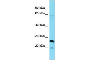Host:  Rabbit  Target Name:  HCFC1  Sample Type:  Uterus Tumor lysates  Antibody Dilution:  1. (HCFC1 antibody  (N-Term))