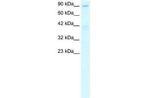 Human Heart; WB Suggested Anti-C20ORF194 Antibody Titration: 2. (C20orf194 antibody  (C-Term))