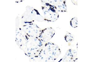 Immunohistochemistry of paraffin-embedded human placenta using RCC1 Rabbit mAb (ABIN1512845, ABIN3021028, ABIN3021029 and ABIN7101332) at dilution of 1:100 (40x lens). (RCC1 antibody)