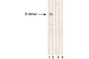 D-dimer, D-monomer and fibrinogen immunodetectionby MAb DD1 in Western blotting. (D-Dimer antibody)