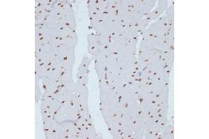 Immunohistochemistry of paraffin-embedded rat heart using Phospho-Chk1-S280 antibody (ABIN3019445, ABIN3019446, ABIN3019447 and ABIN6225372) at dilution of 1:100 (40x lens). (CHEK1 antibody  (pSer280))
