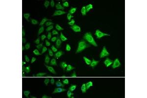 Immunofluorescence analysis of HeLa cells using DHRS2 Polyclonal Antibody