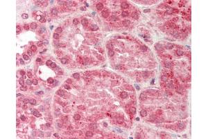 Human Kidney: Formalin-Fixed, Paraffin-Embedded (FFPE). (SERPINA5 antibody  (AA 326-375))