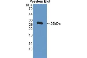 Detection of Recombinant IL17RC, Human using Polyclonal Antibody to Interleukin 17 Receptor C (IL17RC) (IL17RC antibody  (AA 257-477))