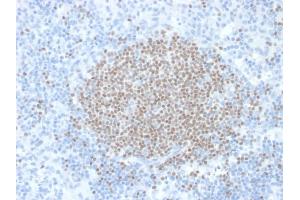 Formalin-fixed, paraffin-embedded human Lymph Node stained with SULT1E1 Mouse Monoclonal Antibody (CPTC-SULT1E1-1).
