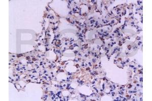 Formalin-fixed and paraffin embedded rat lung tissue labeled with Anti-IFN-gamma Polyclonal Antibody, Unconjugated (ABIN669126) at 1:200, followed by conjugation to the secondary antibody and DAB staining (Interferon gamma antibody  (AA 75-155))