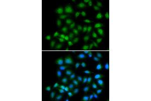 Immunofluorescence analysis of HeLa cells using MXI1 antibody. (MXI1 antibody)